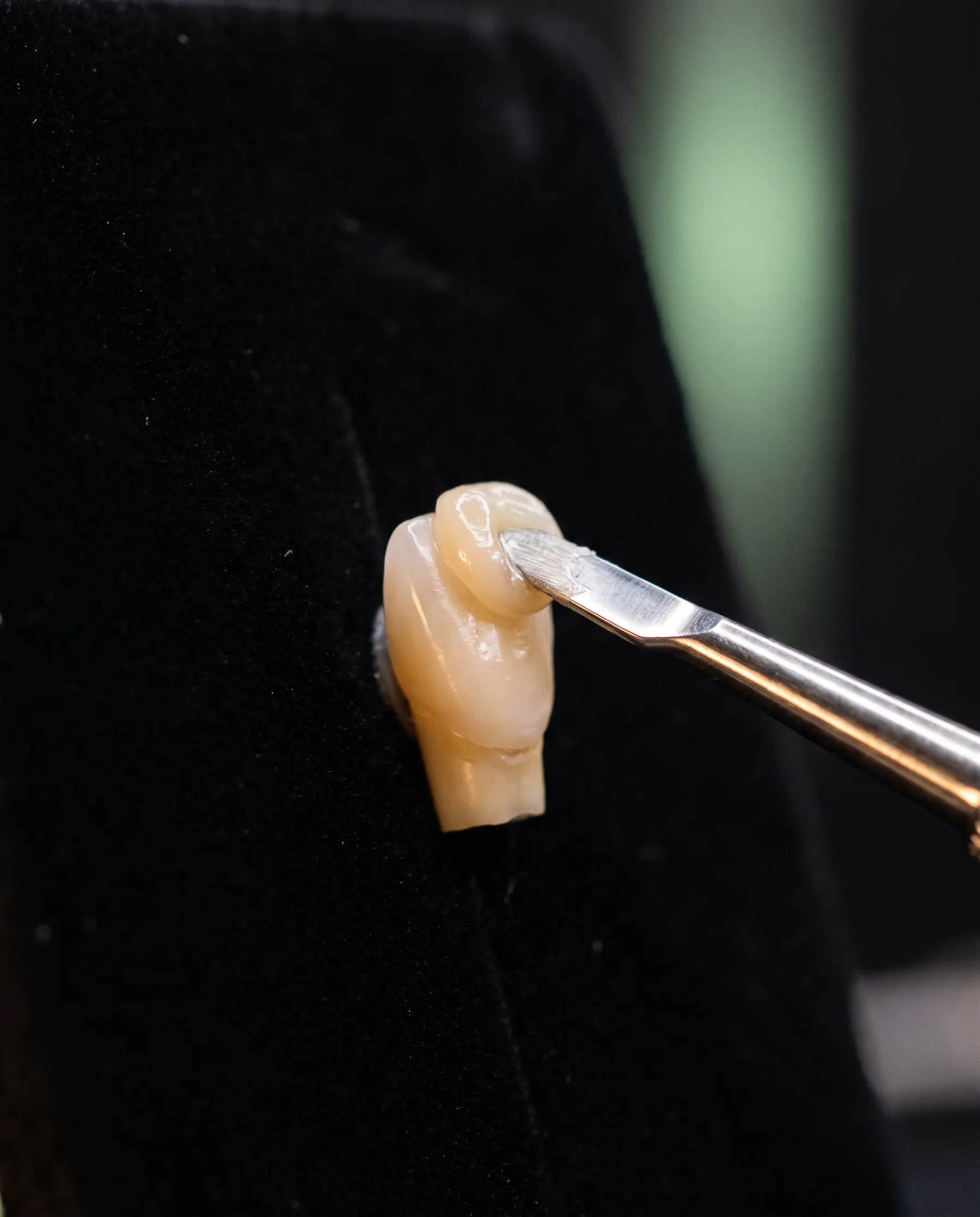 Résine composite déposée en fines couches sur une dent, à l'aide d'une spatule de modelage