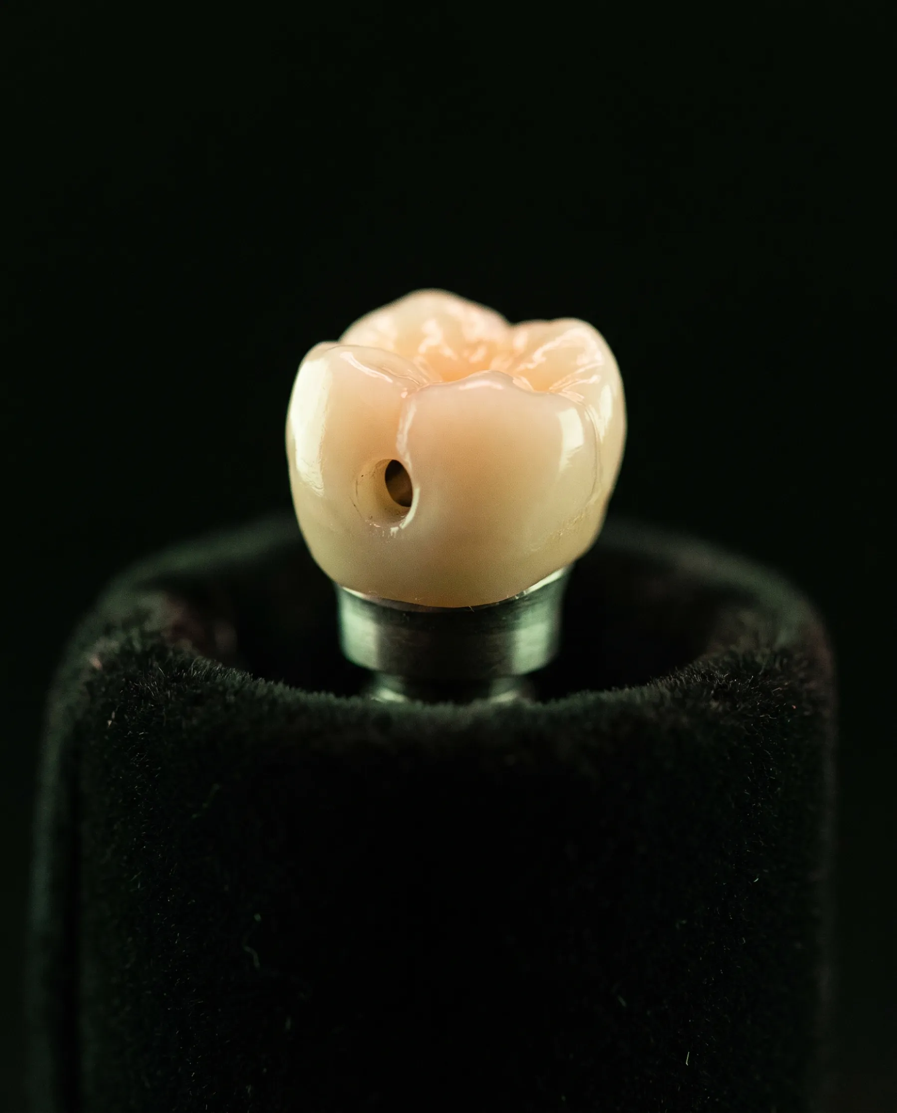 Couronne céramique transvissée, son puits de vissage visible sur la face de mastication, présentée sur un pilier implantaire