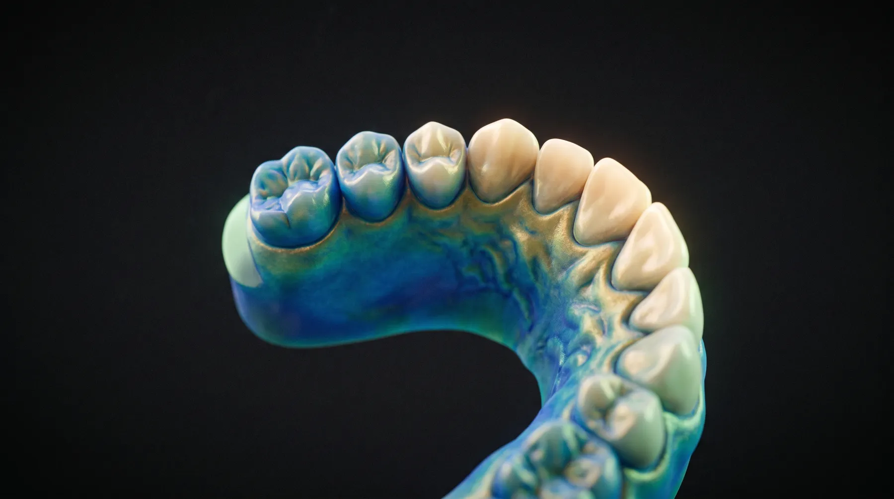 Modèle numérique en trois dimensions d'une arcade dentaire, restitué en bleu et vert après un scan intra-oral